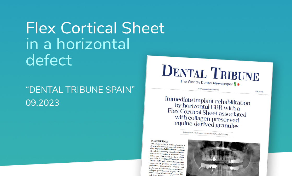 Flex Cortical Sheet