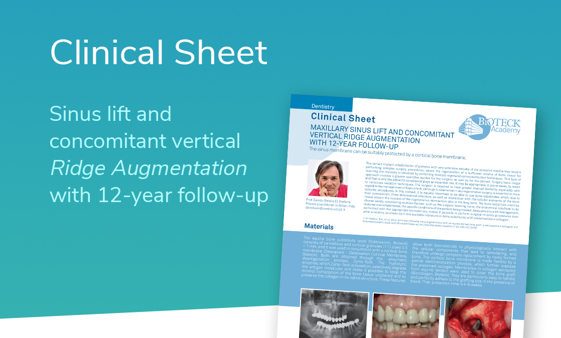 collagen-preserved equine bone