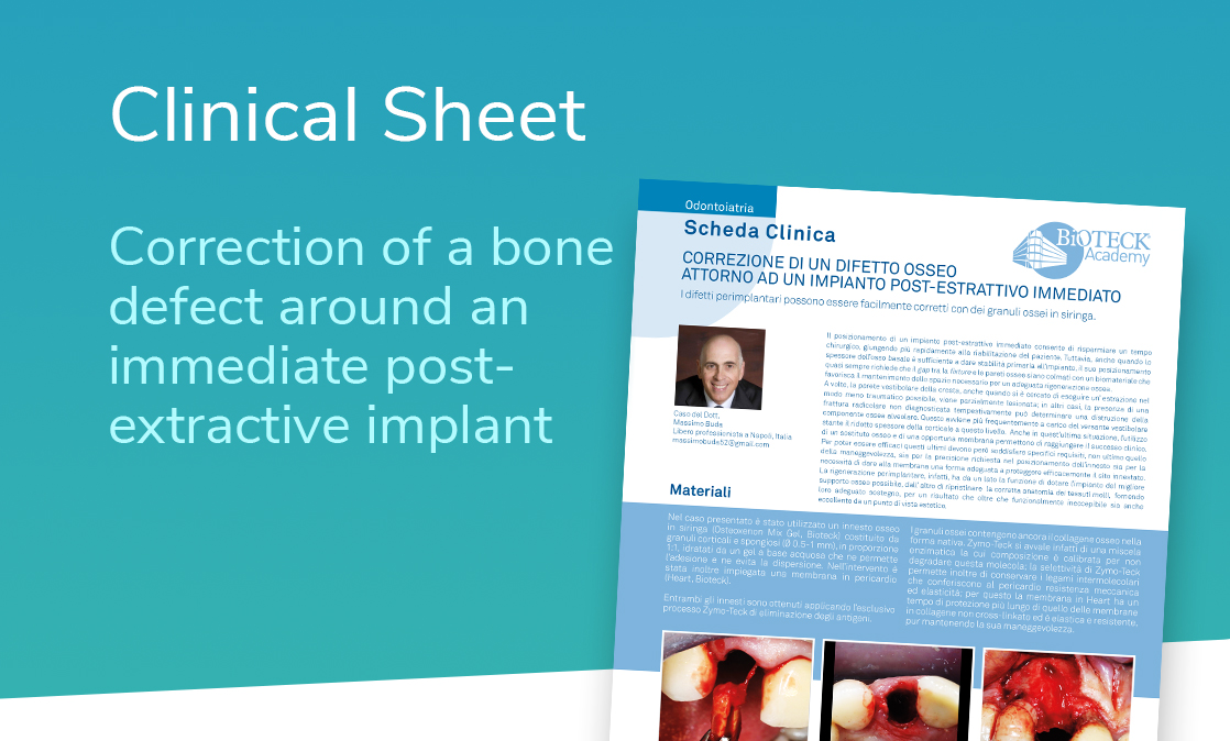 collagen-preserved bone grafts