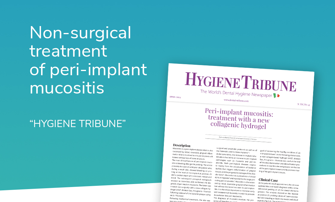 peri-implant mucositis