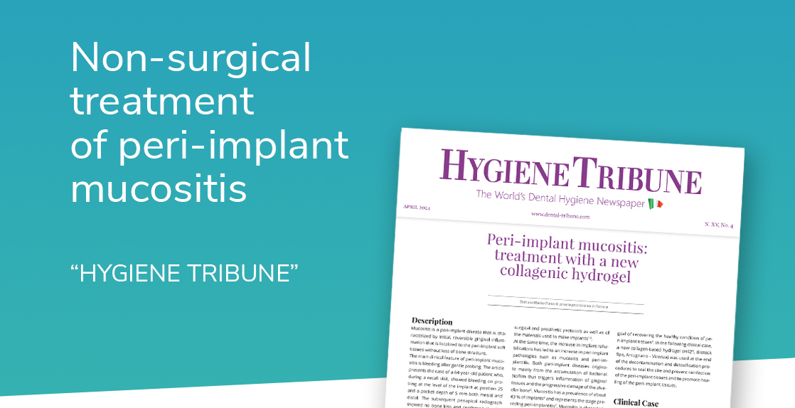peri-implant mucositis