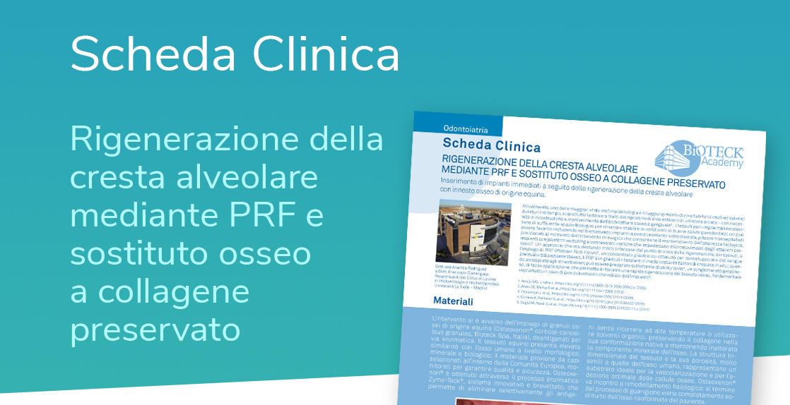 riabilitazione implantare