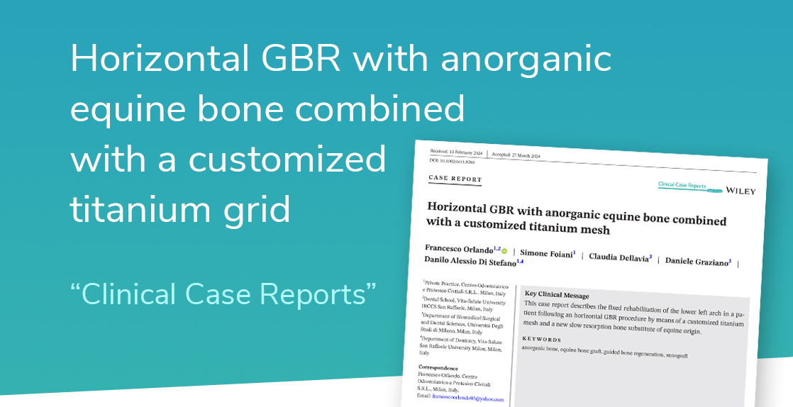 horizontal GBR