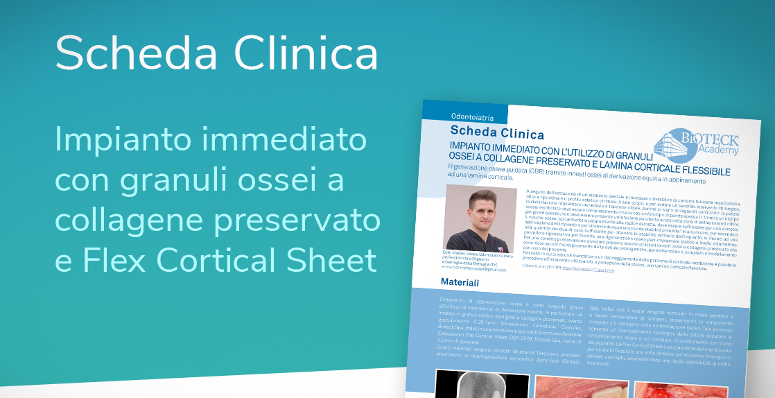 flex cortical sheet
