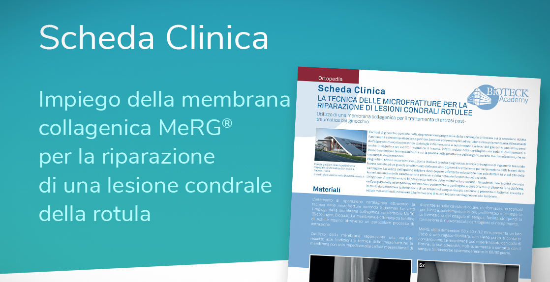 membrana collagenica