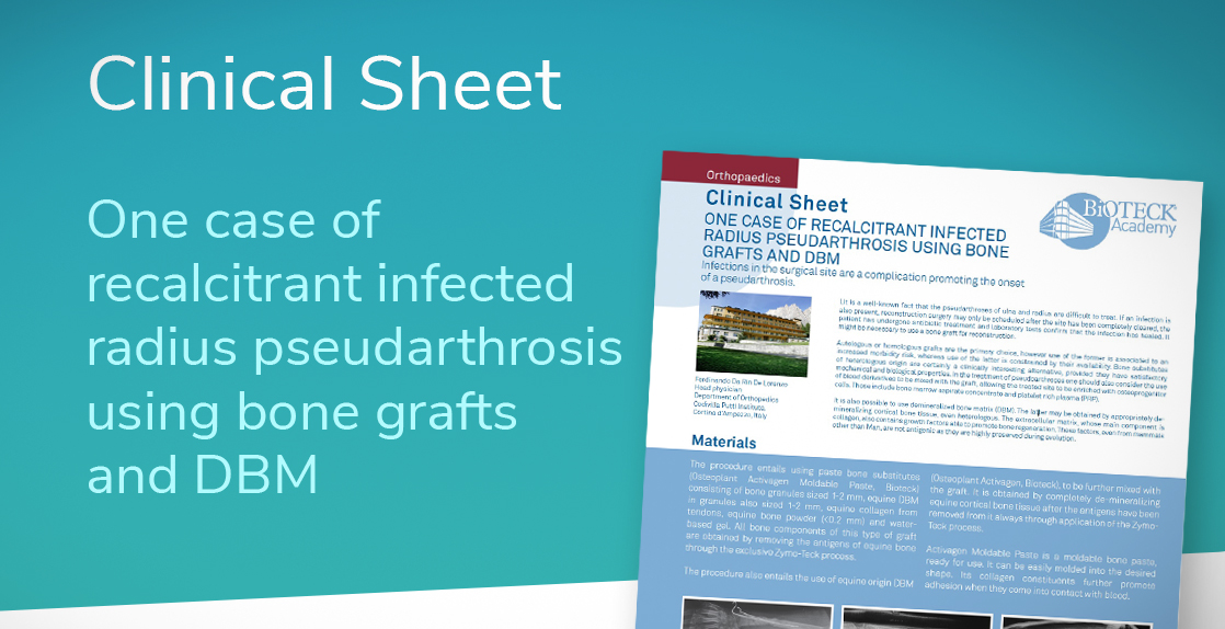bone grafts