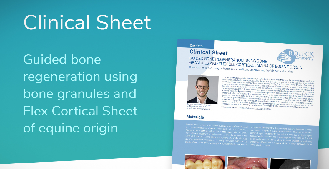 flex cortical sheet