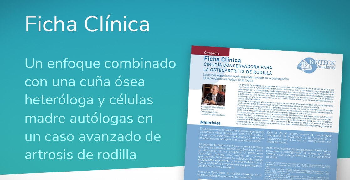 cuña ósea heteróloga y células madre autólogas