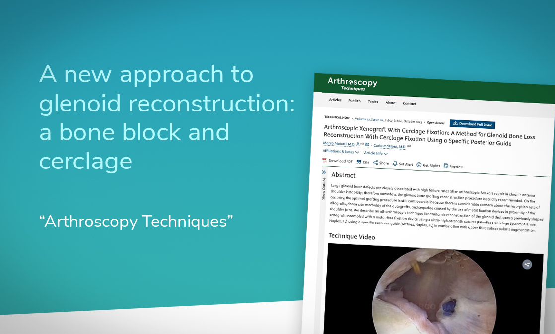 glenoid reconstruction