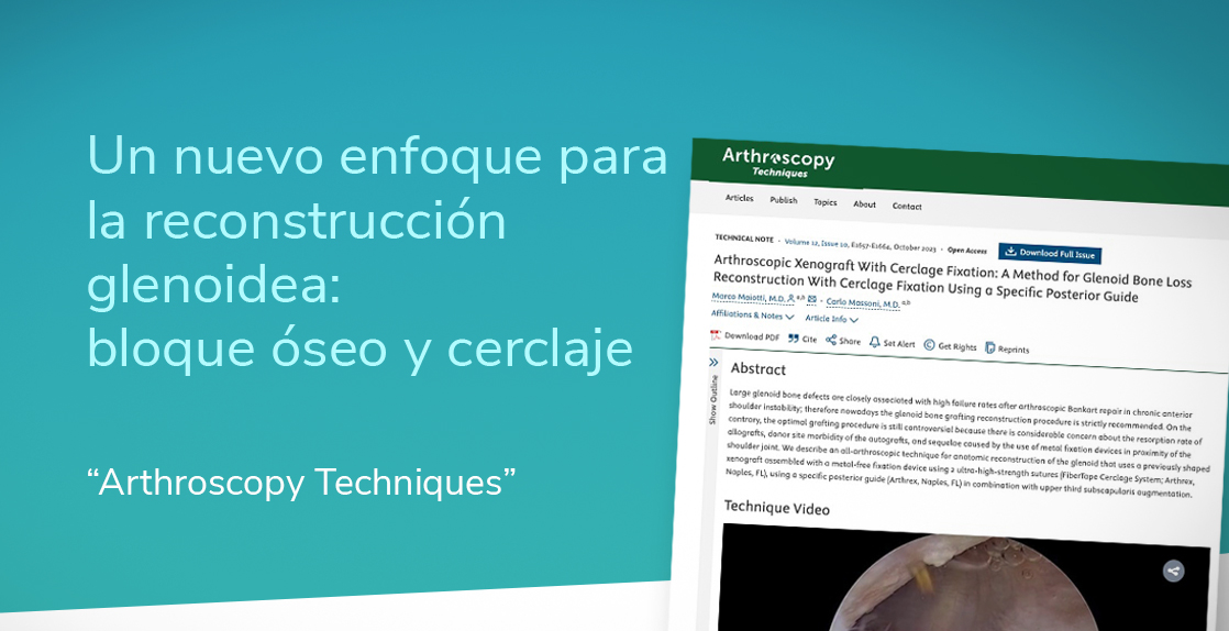 reconstrucción glenoidea