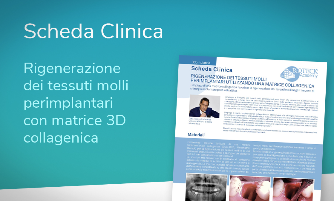 Matrice 3D collagenica