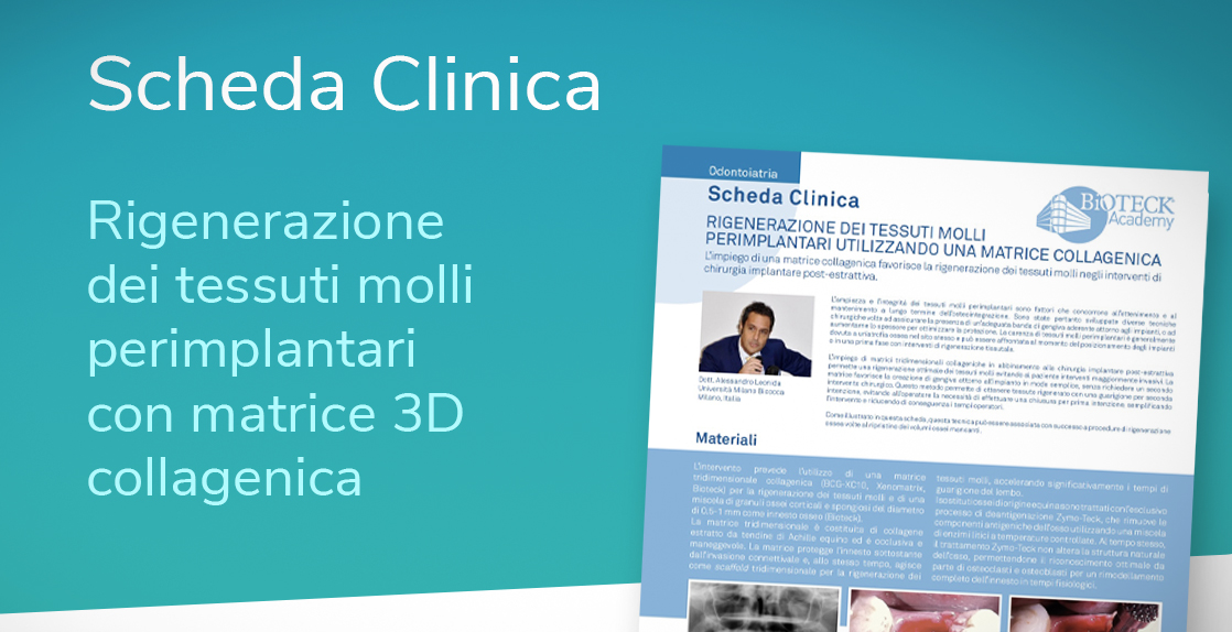 Matrice 3D collagenica